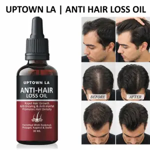 anti-hair-loss-oil-for-hair-growth-shine