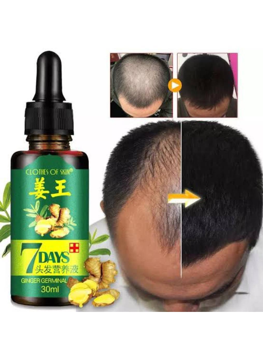 Unisex Hair Growth Essential Oil