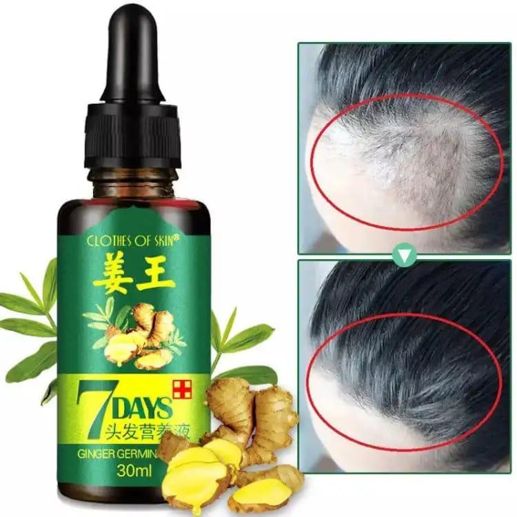 Unisex Hair Growth Essential Oil - Image 4