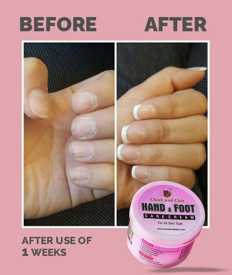 Brightening Hand Foot Cream for Skin - Image 6